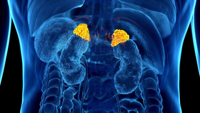 suy tuyến thượng thận do corticoid