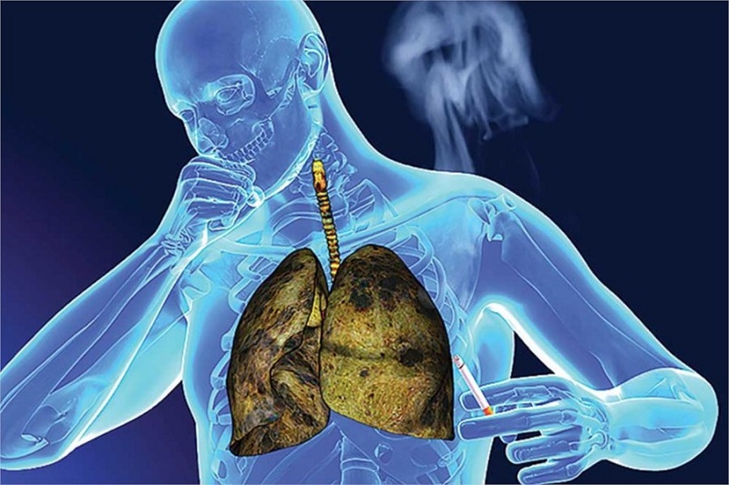 Phát hiện sớm qua sàng lọc định kỳ giúp tăng cơ hội điều trị hiệu quả và có thể đạt được mục tiêu điều trị triệt căn