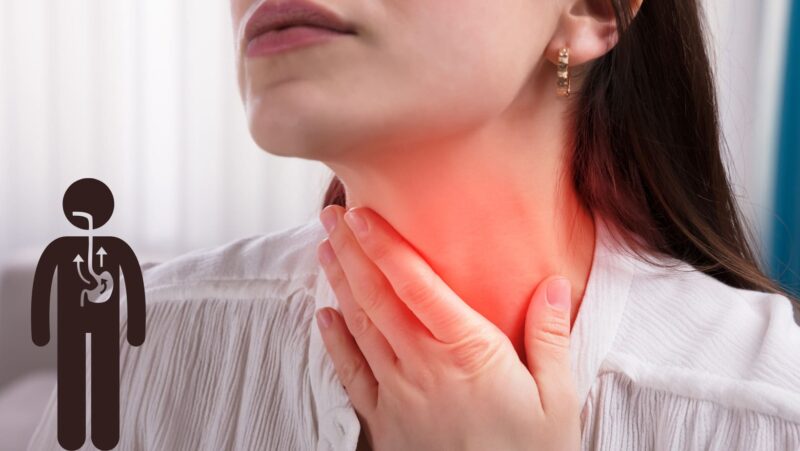 Viêm thực quản độ A tuy chưa nghiêm trọng nhưng không thể trì hoãn điều trị.